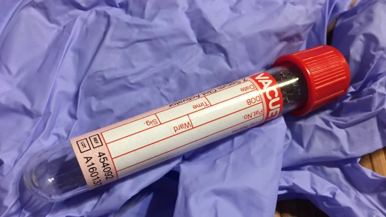 Учёные из Mount Sinai восстановили клетки сердца взрослого человека после травмы