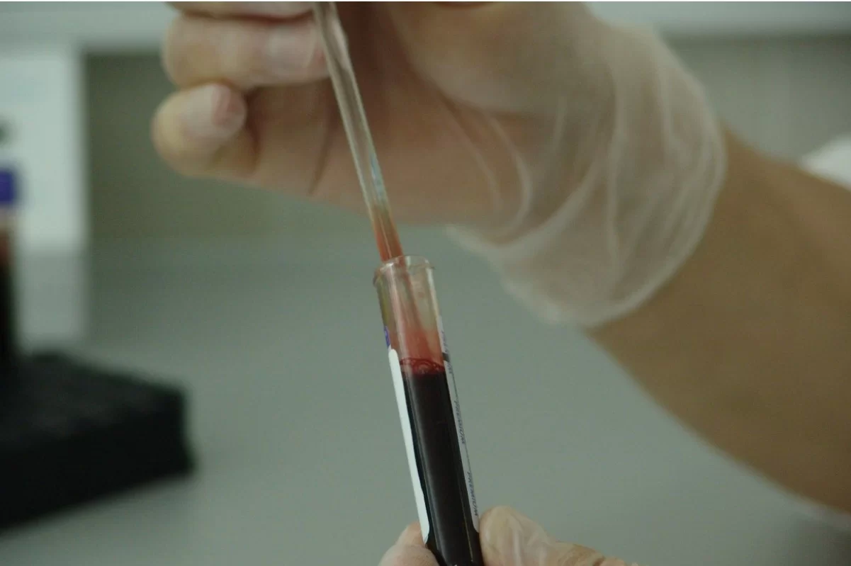 Нарушения режима сна повышают риск гипертонии и апноэ