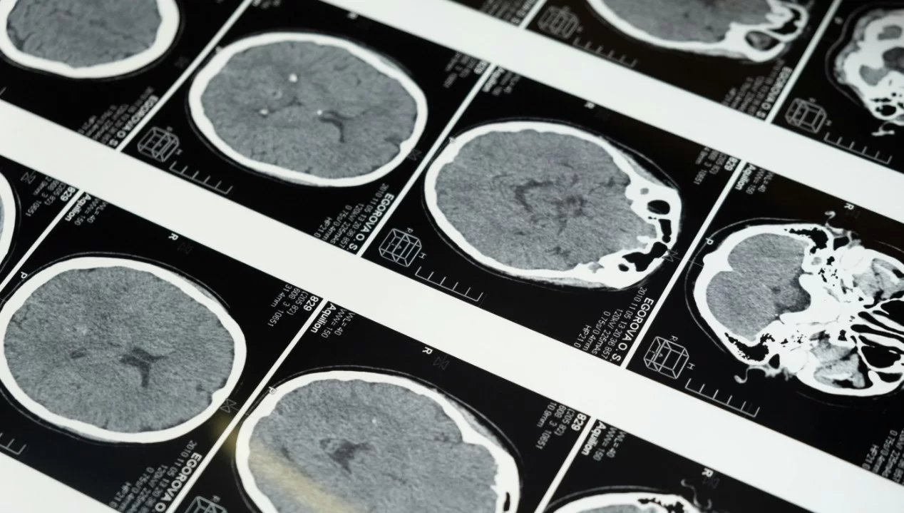 Швейцарские ученые доказали пользу короткого дневного сна для мозга