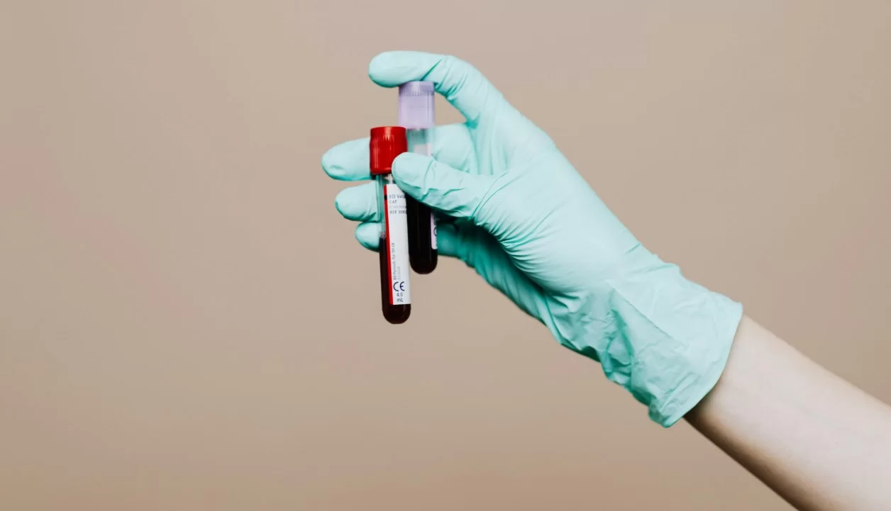 Ученые хотят менструальной кровью заменить мазки на выявление рака шейки матки