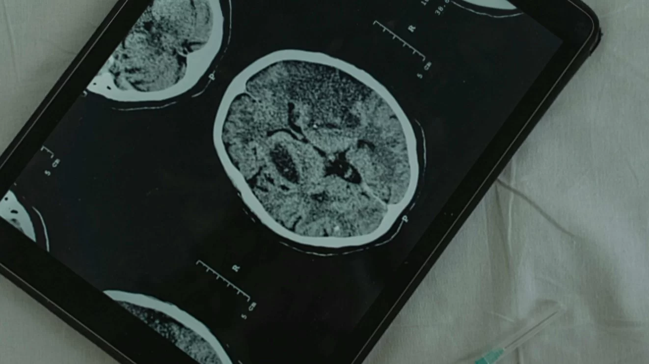 Ученые из Австралии: Зевота меняет движение защитной жидкости мозга