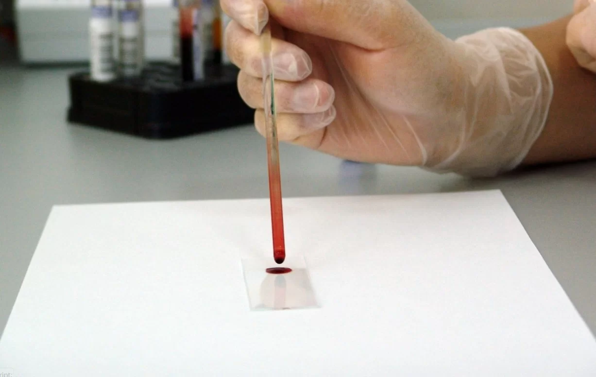 Раскрыта важная роль африканских белок в распространении вируса оспы обезьян